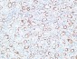 TNF-R1 Polyclonal Antibody